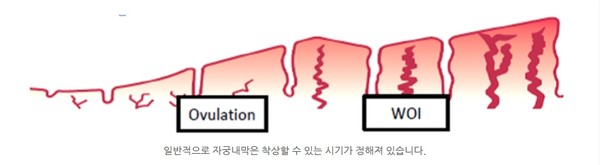 (사진제공=부산, 센텀이룸여성의원)