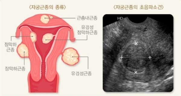 사진제공=서울대병원