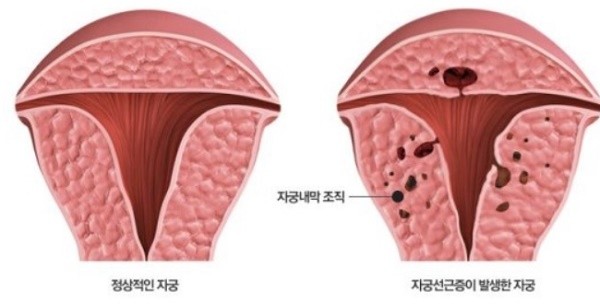 (사진제공=을지대병원)