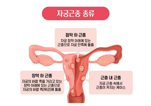 사진출처=서울대병원