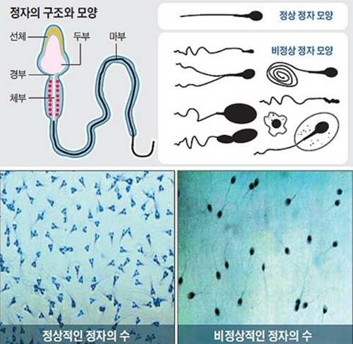 ▲(사진출처=네이버 anypang560 블로그 )