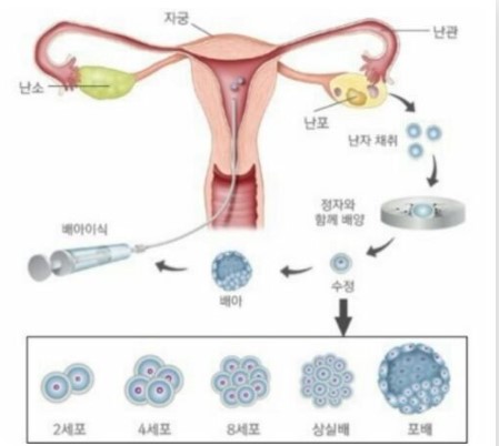 광주시엘병원제공