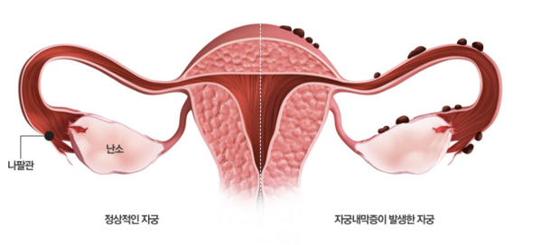 연세아이봄여성의원 제공.