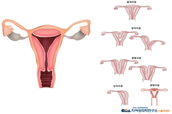 차여성의학연구소 서울역섹터 제공
